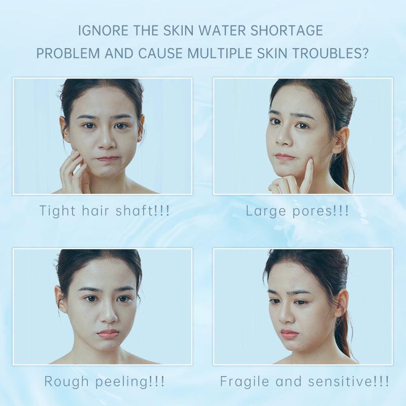 120ml Yeast Balance Water Moisturizing Make-up Water - 2BMAGIC